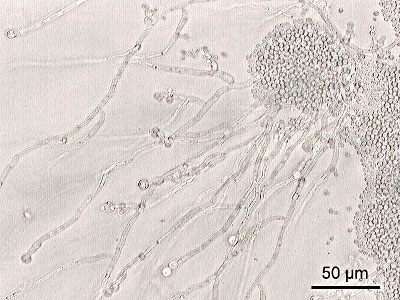 CANDIDA ALBICANS